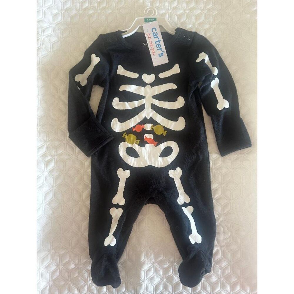Bones